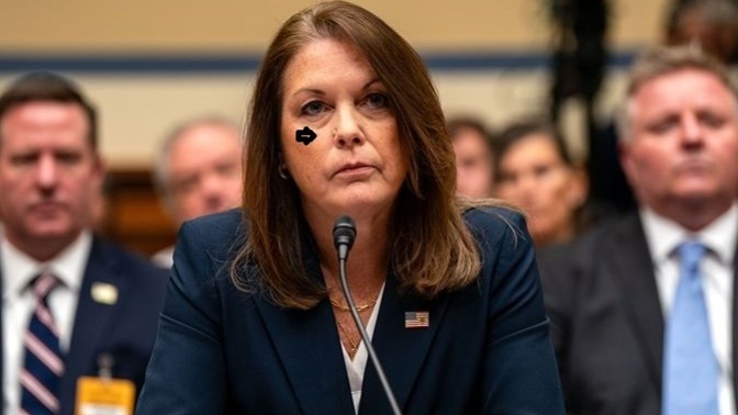 Should Kimberly Cheatle get that thing on her nose looked at? ?