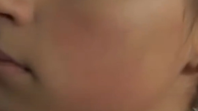 Girls, would you be put off if a Guy has Rosy Cheeks?
