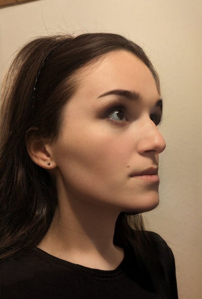 How can I up my makeup to conceal my masculine features? I am getting facial surgery next year but until then what can I can I do in terms of makeup?