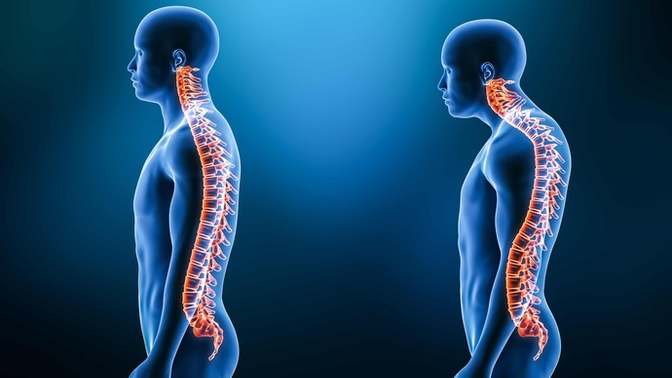 Ladies, if you really hit it off with a guy who has kyphosis, hunchback, would you want to take it to the next level?