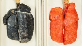 My girlfriend started smoking and I hate it what should I do?