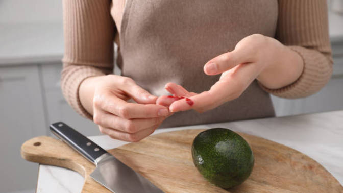 What would you do if your partner accidentally cut their own finger off?