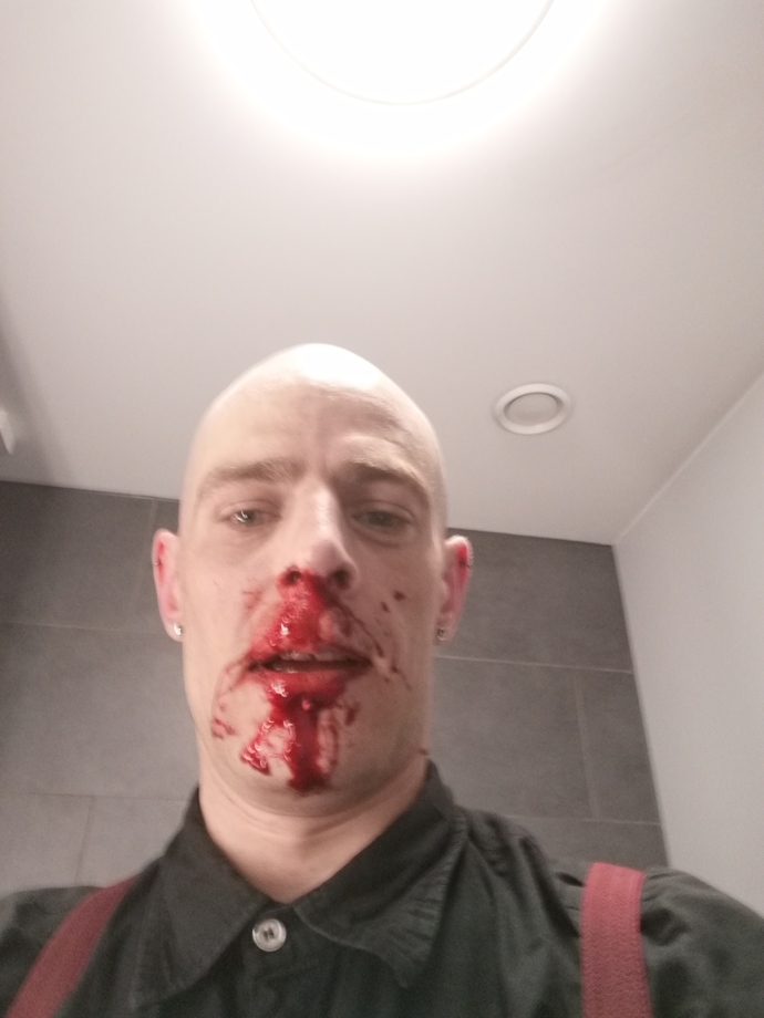 Did you ever beat up a bully?