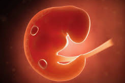 Should there be a ban on abortion?