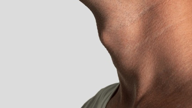 Ladies: Are you attracted to an Adam's apple?