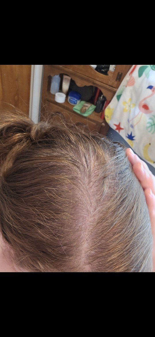 Is it normal to be doing this at 27 years old?