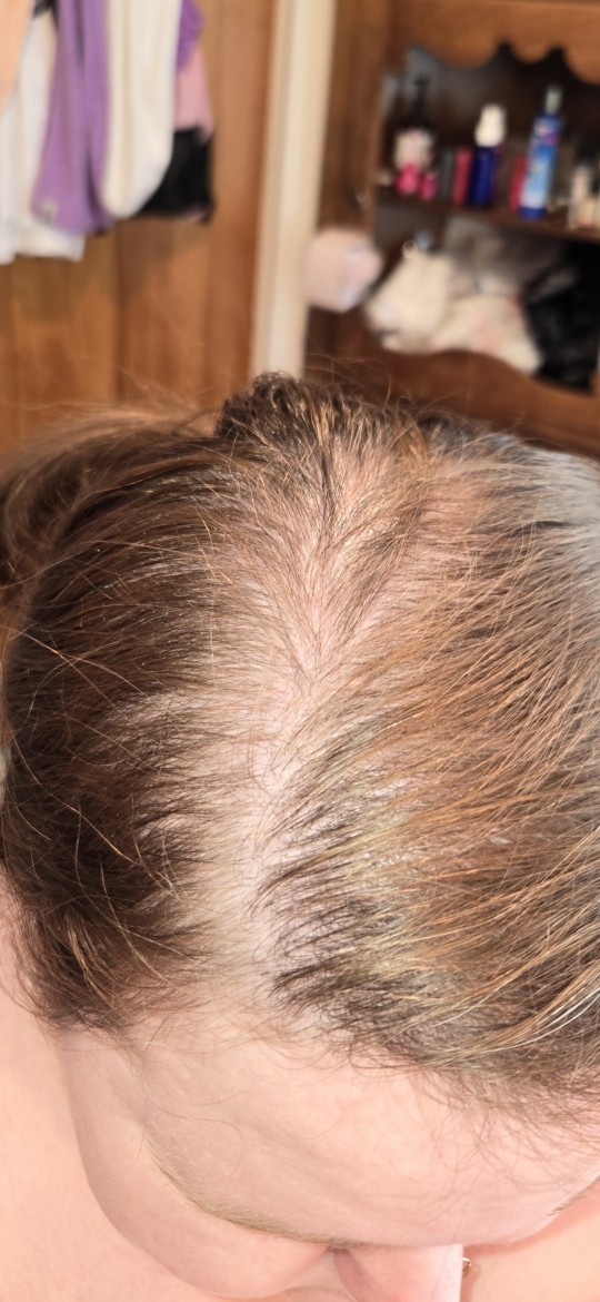 Is it normal to be doing this at 27 years old?
