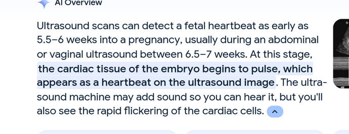 Do you agree with Stacey Abrams that ultrasound machines are completely fake?