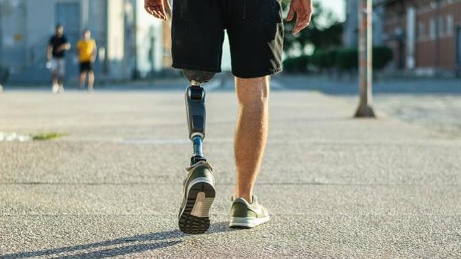 Would you date somebody with a prosthetic arm or leg?