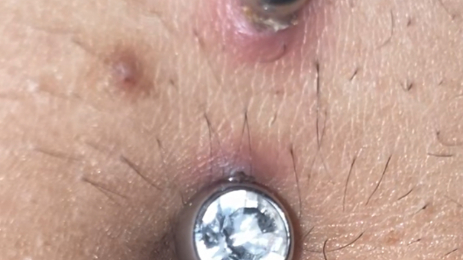 Is my new piercing healing ok?