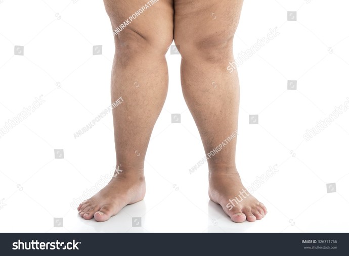 Guys, Are a WOMAN'S LEGS nice to look at?