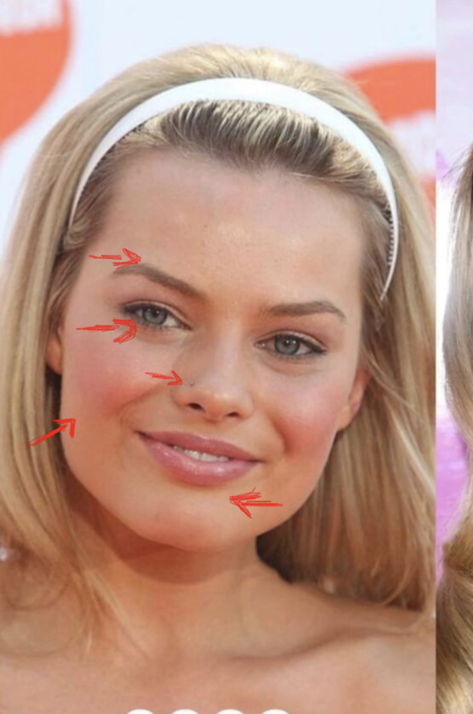 What do you think of people with plastic surgery?