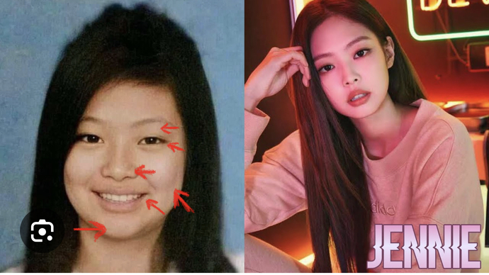 What do you think of people with plastic surgery?
