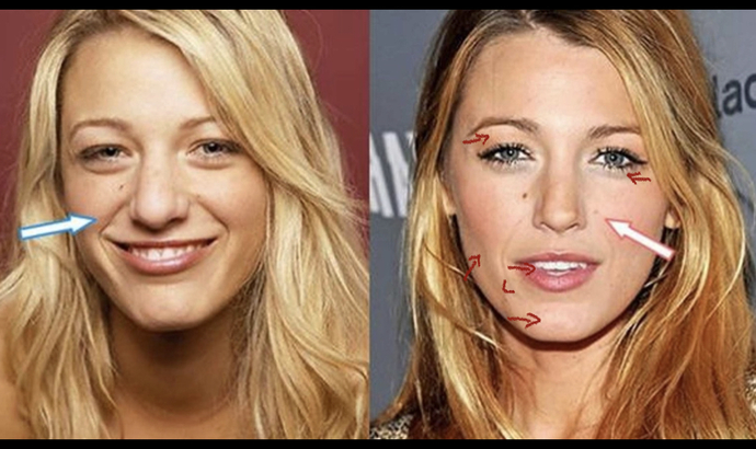 What do you think of people with plastic surgery?
