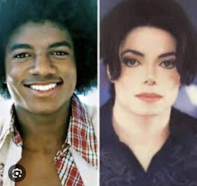 What do you think of people with plastic surgery?