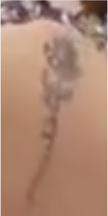 Do you have a tattoo?