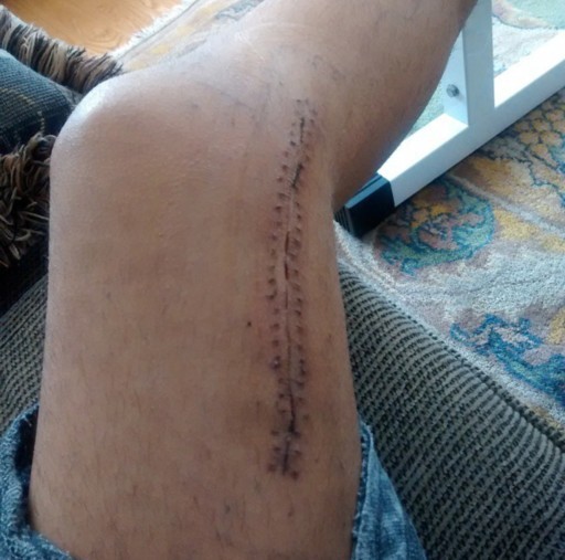 What is the worst physical pain you’ve ever felt?