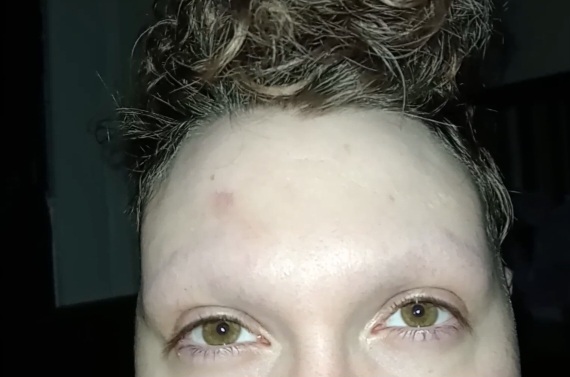 Heeeelp... I accidentally shaved off my brows. How can I make them grow faster?