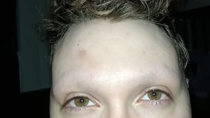 Heeeelp... I accidentally shaved off my brows. How can I make them grow faster?