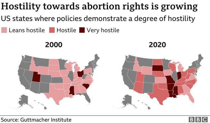Should abortion be legal in the US?