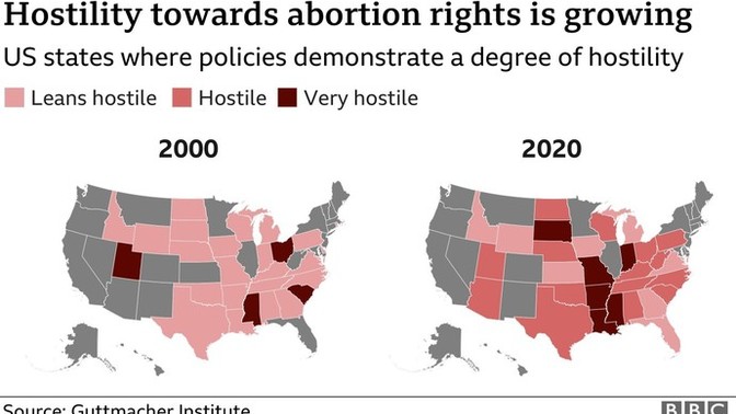 Should abortion be legal in the US?