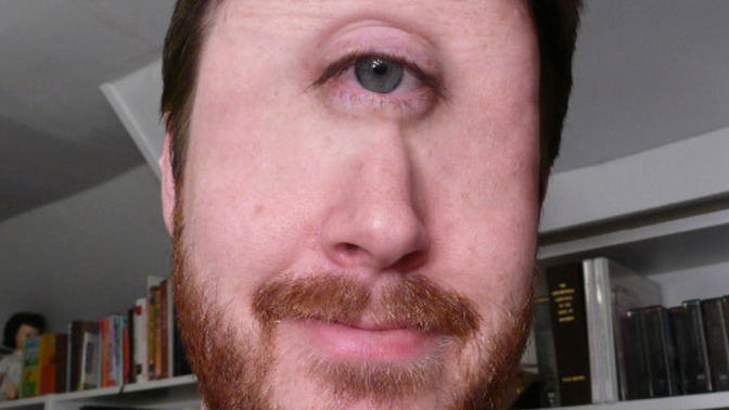 If cyclops were real and you met one could you resist the urge to make fun of their one eye?
