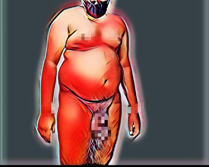When do you think fat shaming is justified?