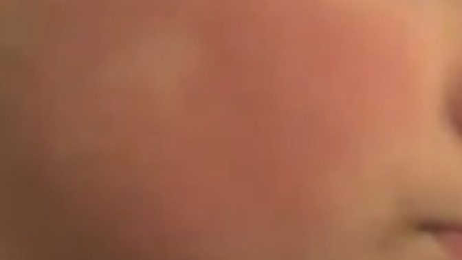 What can I do for red cheeks?