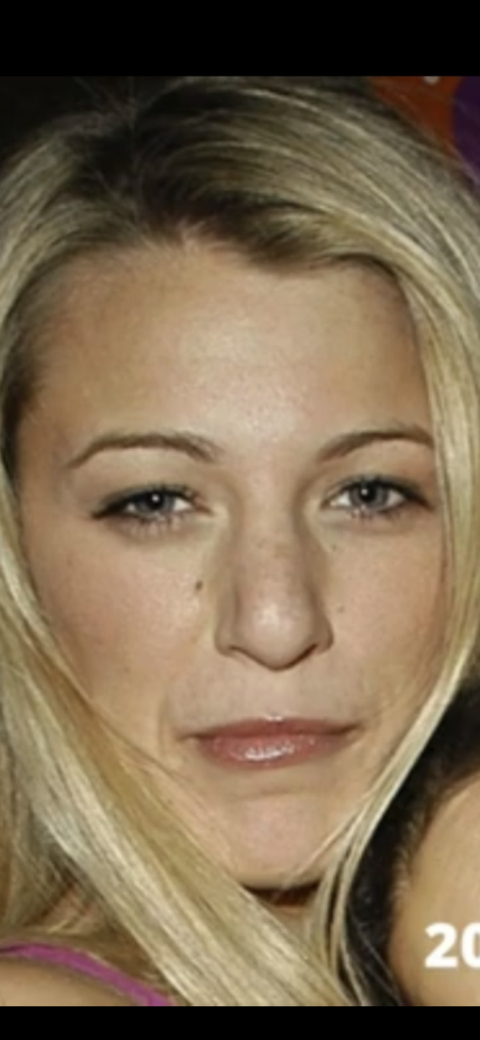 Blake lively is actually ugly, without surgeries would she be able to get away with being such a rude disrespectful person?