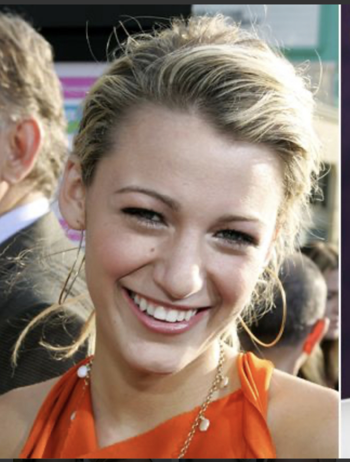 Blake lively is actually ugly, without surgeries would she be able to get away with being such a rude disrespectful person?