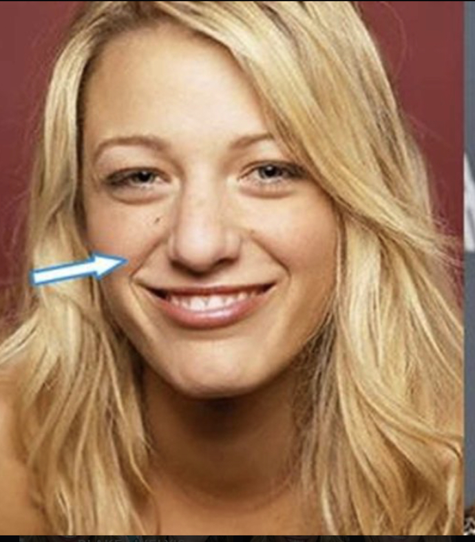 Blake lively is actually ugly, without surgeries would she be able to get away with being such a rude disrespectful person?