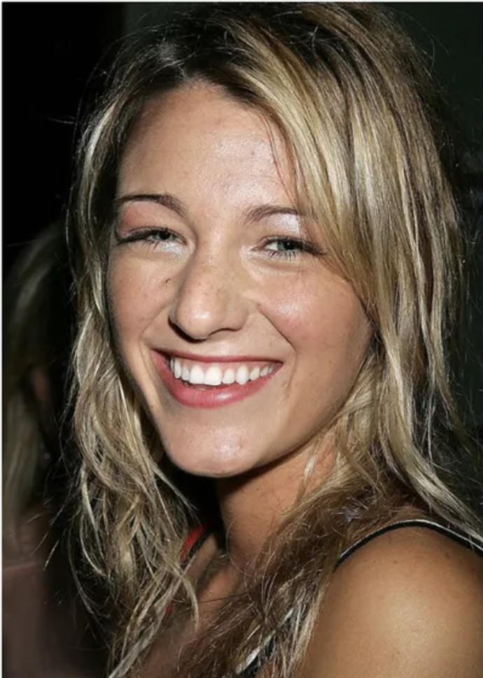 Blake lively is actually ugly, without surgeries would she be able to get away with being such a rude disrespectful person?