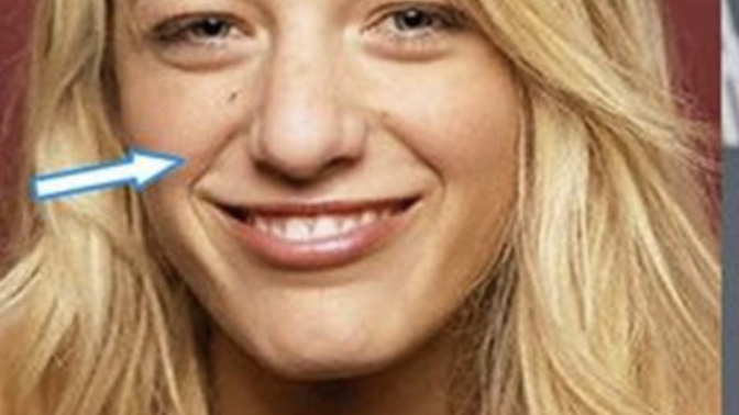 Blake lively is actually ugly, without surgeries would she be able to get away with being such a rude disrespectful person?