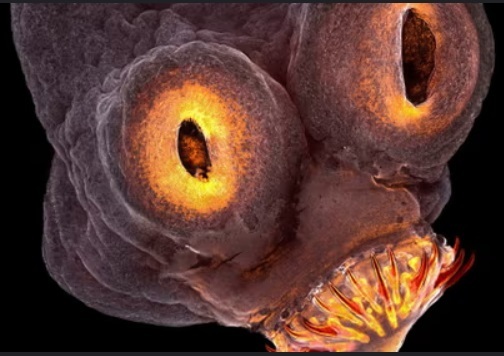 If a worm eats a persons brain, would that make the person smarter or dumber?