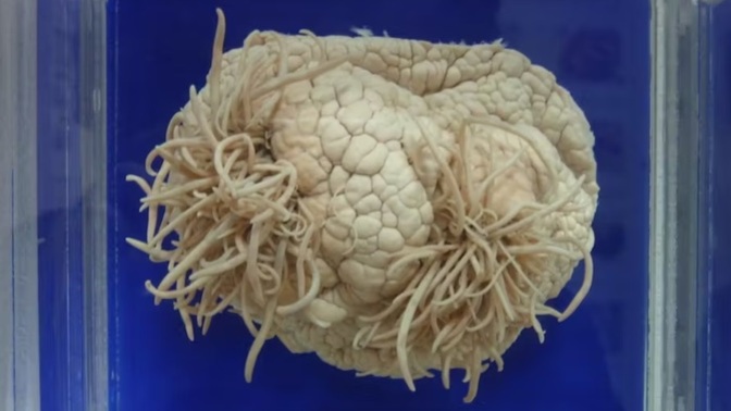 If a worm eats a person's brain, would that make the person smarter or dumber?