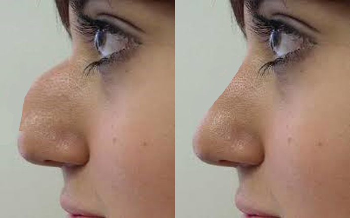 True or false: cosmetic surgery is a sign of the person being insecure?