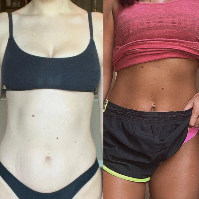 Is it bad that I highly prefer White women who are heavily tanned even though tans can be dangerous and cause skin cancer?