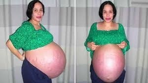 What would you do if you or your partner were pregnant with 8 kids?