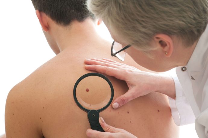 Full skin exam at the dermatologist - would you wear a thong or full coverage underwear?
