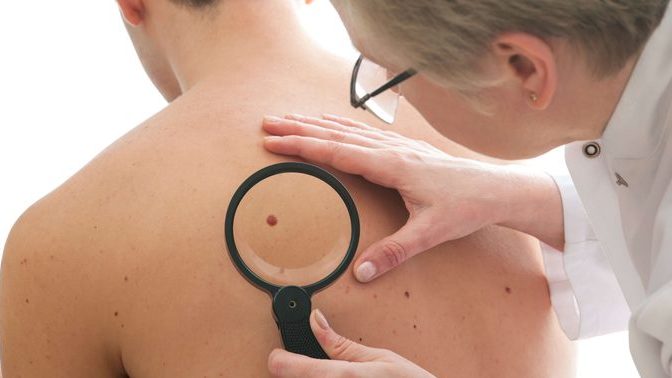 Full skin exam at the dermatologist - would you wear a thong or full coverage underwear?