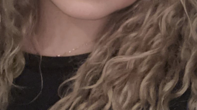 Should I get surgery to look like this filter? ?