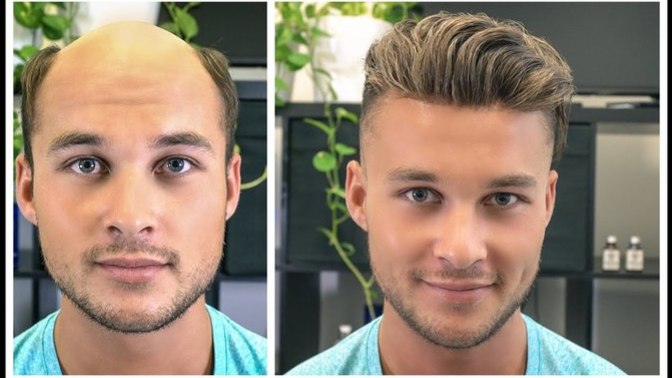Would you date a guy that wore a hair system?