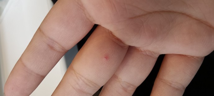 What are these red dots?