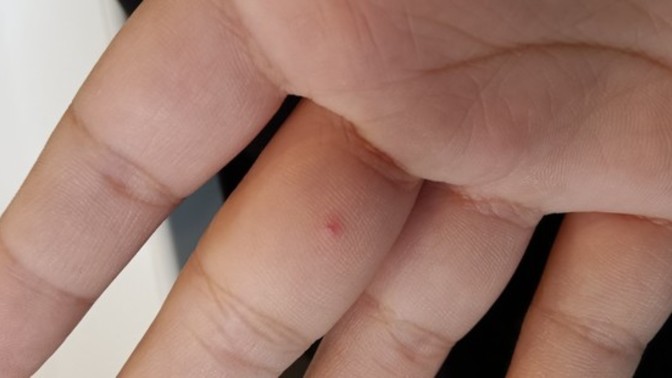 What are these red dots?
