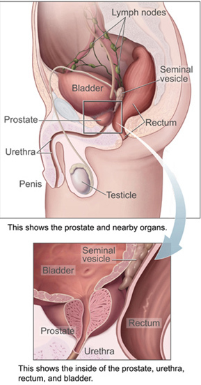 Narrow Urethra. Is this a common white man problem?