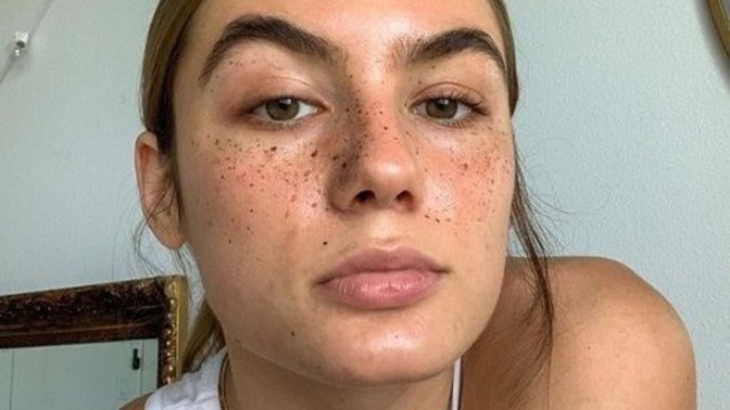 Would you pay to have freckles tattooed on you?