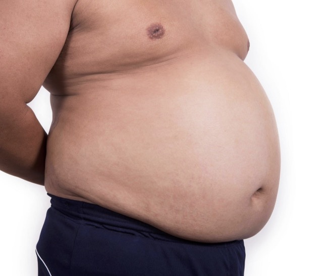What is the most physically unattractive trait for a man?