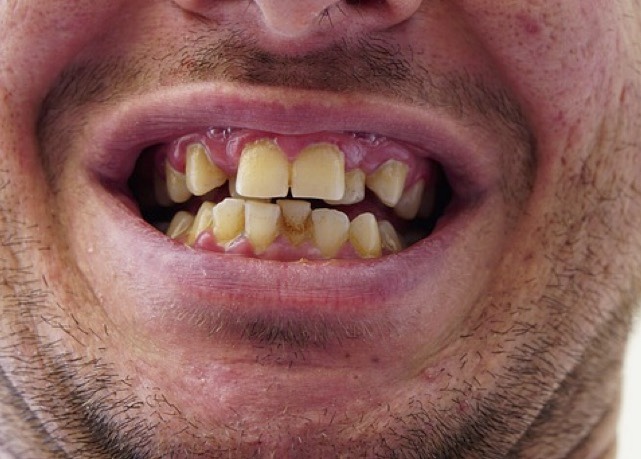 What is the most physically unattractive trait for a man?