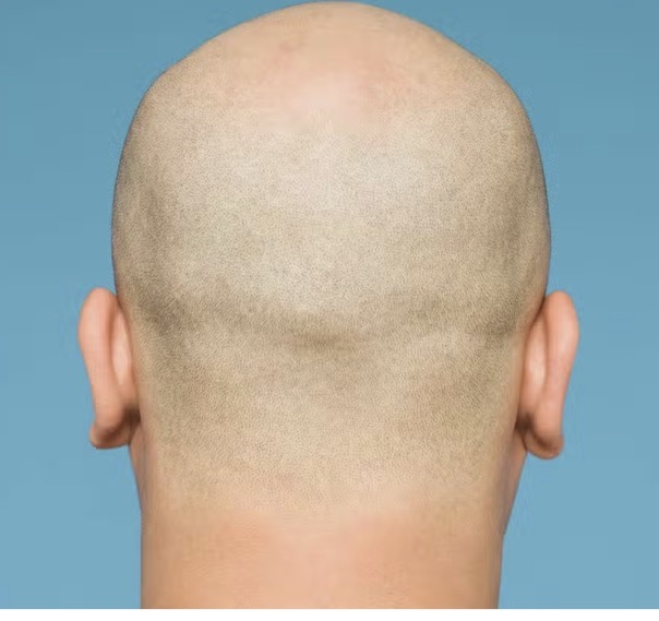 What is the most physically unattractive trait for a man?