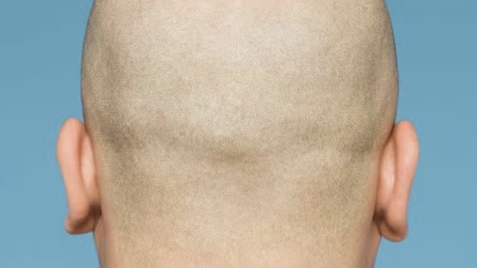 What is the most physically unattractive trait for a man?